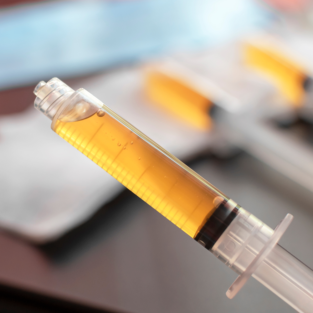 PRP - Plasma Treatment.